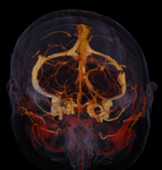 Apeikonish Egkefalou