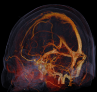 Apeikonish Egkefalou